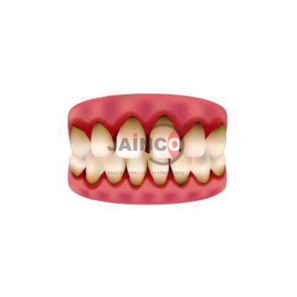 Gum of Scurvy Model